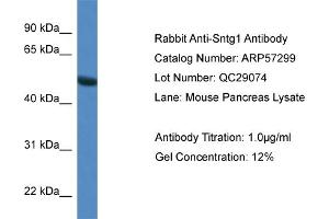 Western Blotting (WB) image for anti-Syntrophin, gamma 1 (SNTG1) (N-Term) antibody (ABIN2787161) (Syntrophin gamma 1 anticorps  (N-Term))