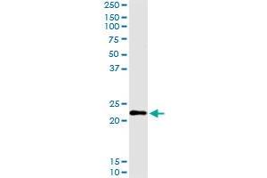 anti-Chorionic Gonadotropin, beta Polypeptide (CGB) (AA 1-165) antibody