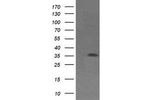 Western Blotting (WB) image for anti-T-cell surface glycoprotein CD1c (CD1C) antibody (ABIN1497192)