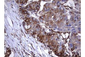 Image no. 8 for anti-Tumor Necrosis Factor Receptor Superfamily, Member 8 (TNFRSF8) (AA 19-379) antibody (ABIN1491084)