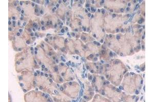 Detection of MYL6B in Rat Pancreas Tissue using Polyclonal Antibody to Myosin Light Chain 6B, Alkali, Smooth Muscle And Non Muscle (MYL6B)