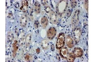 Immunohistochemical staining of paraffin-embedded Human Kidney tissue using anti-PGM3 mouse monoclonal antibody. (Phosphoglucomutase 3 anticorps)