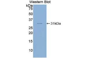 Western blot analysis of the recombinant protein. (SMAD6 anticorps  (AA 116-364))