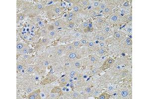 Immunohistochemistry of paraffin-embedded Human liver using GLA Polyclonal Antibody at dilution of 1:100 (40x lens). (GLA anticorps)