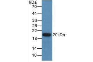 Detection of Recombinant GREM1, Human using Polyclonal Antibody to Gremlin 1 (GREM1)