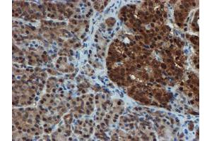 Image no. 13 for anti-Proteasome Subunit alpha 6 (PSMA6) antibody (ABIN1500464)