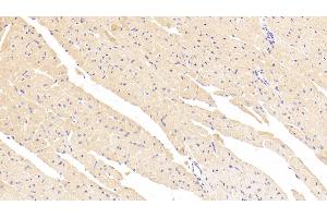 Detection of SCFR in Mouse Heart Tissue using Polyclonal Antibody to Stem Cell Factor Receptor (SCFR)