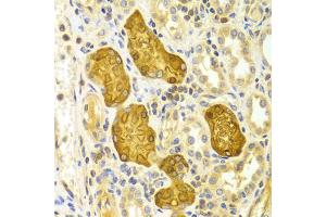 Immunohistochemistry of paraffin-embedded Human kidney using PRKCE antibody (ABIN5971136) at dilution of 1/100 (40x lens). (PKC epsilon anticorps)