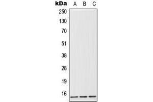 Western blot analysis of FABP1 expression in HeLa (A), Jurkat (B), rat liver (C) whole cell lysates. (FABP1 anticorps  (Center))
