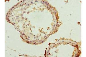 Immunohistochemistry of paraffin-embedded human testis tissue using ABIN7168074 at dilution of 1:100 (Rhotekin anticorps  (AA 304-563))