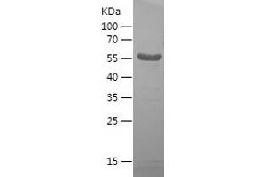 Western Blotting (WB) image for Drebrin 1 (DBN1) (AA 480-649) protein (His-IF2DI Tag) (ABIN7122708)
