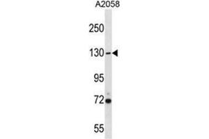 USP7 Antibody (Center) western blot analysis in A2058 cell line lysates (35 µg/lane). (USP7 anticorps  (Middle Region))