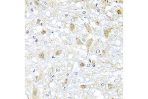 Immunohistochemistry of paraffin-embedded rat brain using C1 antibody (ABIN3016169, ABIN3016170, ABIN3016171 and ABIN6219598) at dilution of 1:100 (40x lens).