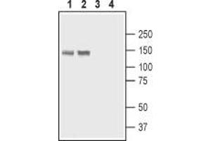 Western blot analysis of rat stomach lysate (lanes 1 and 3) and rat lung membranes (lanes 2 and 4): - 1,2. (ATP2B4 anticorps  (2nd Cytoplasmic Loop))