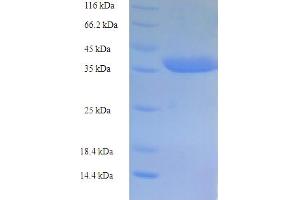 SDS-PAGE (SDS) image for Caspase 5, Apoptosis-Related Cysteine Peptidase (CASP5) (AA 137-327), (partial) protein (His-SUMO Tag) (ABIN5709203)