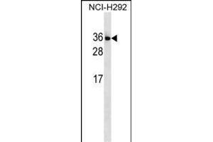 IL34 Antibody (N-term) (ABIN1539235 and ABIN2849950) western blot analysis in NCI- cell line lysates (35 μg/lane). (IL-34 anticorps  (N-Term))