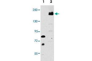 Western blot analysis of LRP6 (arrow) using rabbit LRP6 polyclonal antibody .