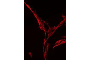 ABIN6275021 staining RAW264. (ST6GAL1 anticorps  (Internal Region))