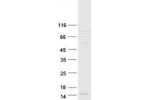 Validation with Western Blot