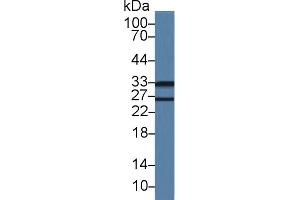 Western blot analysis of Mouse Lung lysate, using Mouse LDLRAP1 Antibody (1 µg/ml) and HRP-conjugated Goat Anti-Rabbit antibody ( (LDLRAP1 anticorps  (AA 1-308))