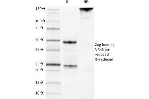 SDS-PAGE Analysis Purified CD22 Mouse Monoclonal Antibody (MYG13). (CD22 anticorps)