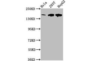 Western Blot Positive WB detected in: Hela whole cell lysate, 293T whole cell lysate, HepG2 whole cell lysate All lanes: LRPPRC antibody at 4 μg/mL Secondary Goat polyclonal to rabbit IgG at 1/50000 dilution Predicted band size: 158 kDa Observed band size: 158 kDa (LRPPRC anticorps  (AA 901-1036))