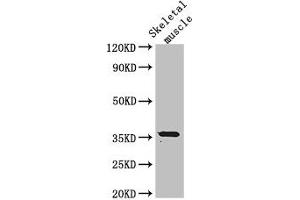 Western Blot Positive WB detected in: Mouse skeletal muscle tissue All lanes: EPM2A antibody at 3 μg/mL Secondary Goat polyclonal to rabbit IgG at 1/50000 dilution Predicted band size: 36, 38, 16, 25, 10, 21, 23 kDa Observed band size: 36 kDa (EPM2A anticorps  (Isoform 9))