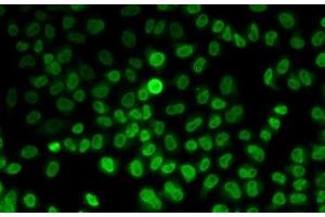 Immunofluorescence analysis of MCF7 cells using ASMT Polyclonal Antibody