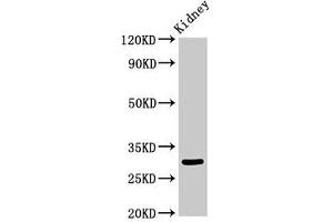 Western Blot Positive WB detected in: Rat kidney tissue All lanes: IGFBP7 antibody at 3. (IGFBP7 anticorps  (AA 64-171))