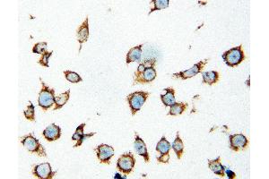 Anti-HSP60 antibody, ICC ICC: SMMC Cell