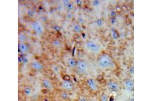 Used in DAB staining on fromalin fixed paraffin-embedded Brain tissue (FAM19A4 anticorps  (AA 46-139))