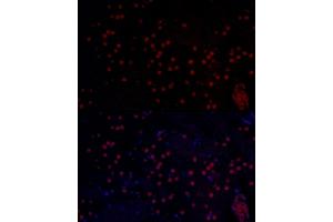 Immunofluorescence analysis of mouse brain using MYCN Rabbit pAb (ABIN1680957, ABIN3015161, ABIN3015163 and ABIN6213865) at dilution of 1:50 (40x lens). (MYCN anticorps  (AA 168-267))