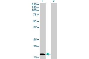 Western Blot analysis of NME3 expression in transfected 293T cell line by NME3 monoclonal antibody (M13), clone 3G10. (NME3 anticorps  (AA 73-169))