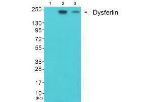 Western blot analysis of extracts from JK cells (Lane 2) and K562 cells (Lane 3), using Dysferlin antiobdy. (Dysferlin anticorps)