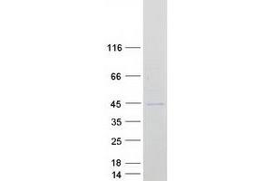 Validation with Western Blot