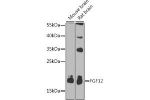 Western blot analysis of extracts of various cell lines, using FGF12 antibody (ABIN3016419, ABIN3016420, ABIN1679841 and ABIN6219744) at 1:1000 dilution.