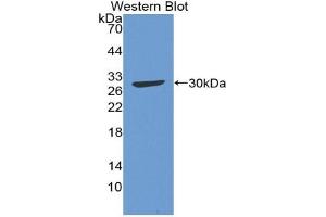 Detection of Recombinant C4, Gallus using Polyclonal Antibody to Complement Component 4 (C4) (Complement C4 anticorps  (AA 1428-1660))