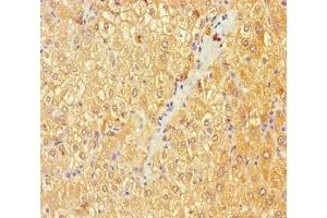 Immunohistochemistry of paraffin-embedded human liver tissue using ABIN7145392 at dilution of 1:100 (B4GALT3 anticorps  (AA 34-393))