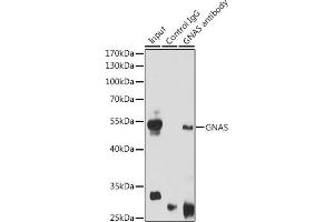 Immunoprecipitation analysis of 200 μg extracts of Mouse brain cells using 3 μg GNAS antibody (ABIN6127959, ABIN6141213, ABIN6141214 and ABIN6221191). (GNAS anticorps  (AA 1-394))
