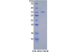 SDS-PAGE analysis of Mouse SUV420H2 Protein. (SUV420H2/KMT5C Protéine)
