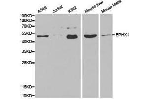 Western Blotting (WB) image for anti-Epoxide Hydrolase 1, Microsomal (Xenobiotic) (EPHX1) antibody (ABIN1872557) (EPHX1 anticorps)