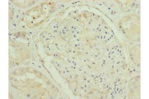 Immunohistochemistry of paraffin-embedded human kidney tissue using ABIN7151254 at dilution of 1:100 (TRIM31 anticorps  (AA 186-425))