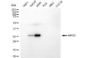 Western blotting analysis using HPGD antibody (ABIN7799013).