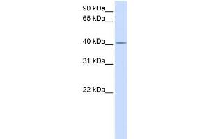 WB Suggested Anti-C2orf18 Antibody Titration:  0. (SLC35F6 anticorps  (Middle Region))