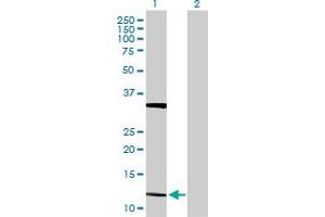 Western Blot analysis of FGF5 expression in transfected 293T cell line by FGF5 MaxPab polyclonal antibody. (FGF5 anticorps  (AA 1-123))