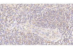 Detection of MFAP4 in Human Spleen Tissue using Polyclonal Antibody to Microfibrillar Associated Protein 4 (MFAP4)