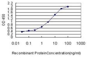 Detection limit for recombinant GST tagged STK38 is approximately 0.