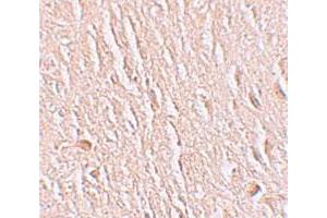 Immunohistochemical staining of human brain cells with LRRTM3 polyclonal antibody  at 2. (LRRTM3 anticorps  (C-Term))