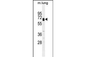 Western blot analysis in mouse lung tissue lysates (35ug/lane). (Glypican 3 anticorps  (C-Term))