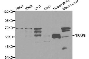 Western blot analysis of extracts of various cell lines, using TRAF6 antibody (ABIN5970361) at 1/1000 dilution. (TRAF6 anticorps)